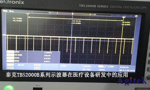 泰克TBS2000B系列示波器在醫(yī)療設(shè)備研發(fā)中的應(yīng)用(圖1)